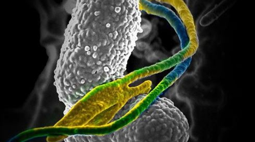 Superbugs – on the frontiers of sustainability